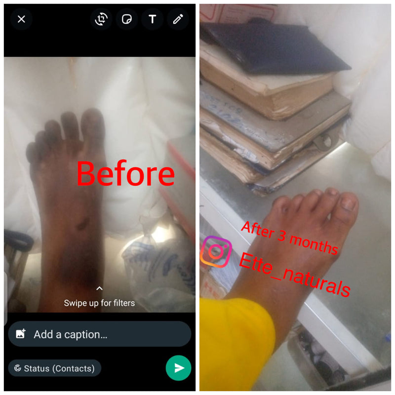 Client result