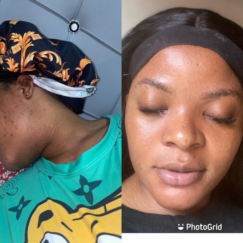 Client result