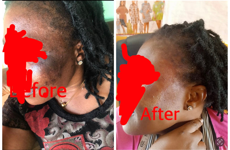 Before and after
