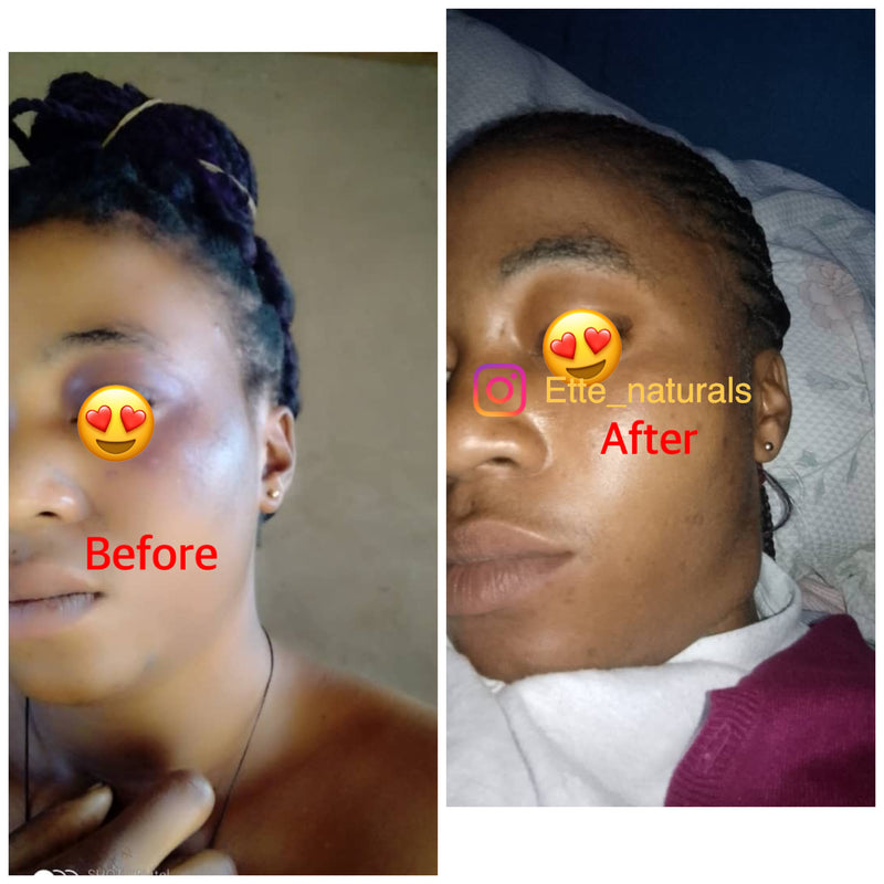 Client result