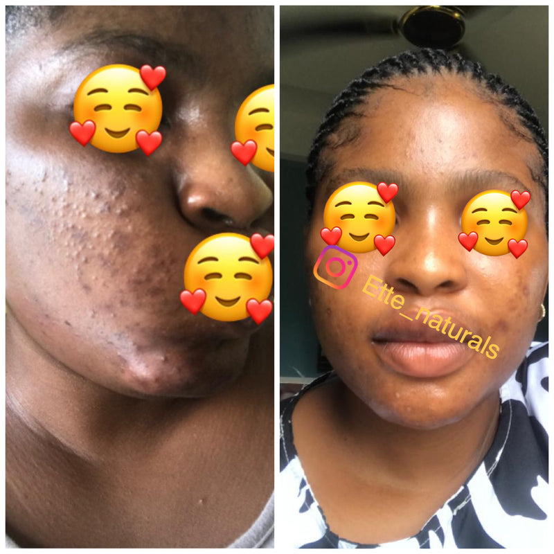 Client result