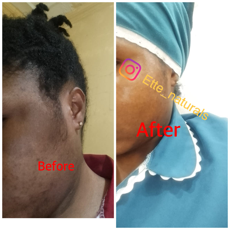 Client result
