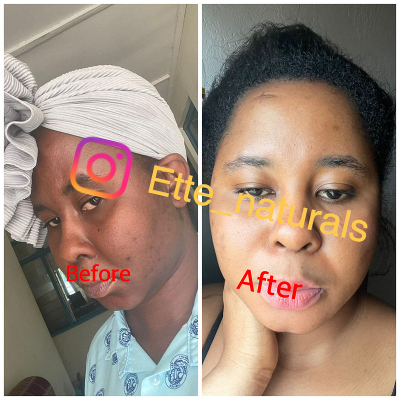 Before and after