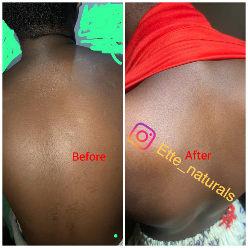 Client result