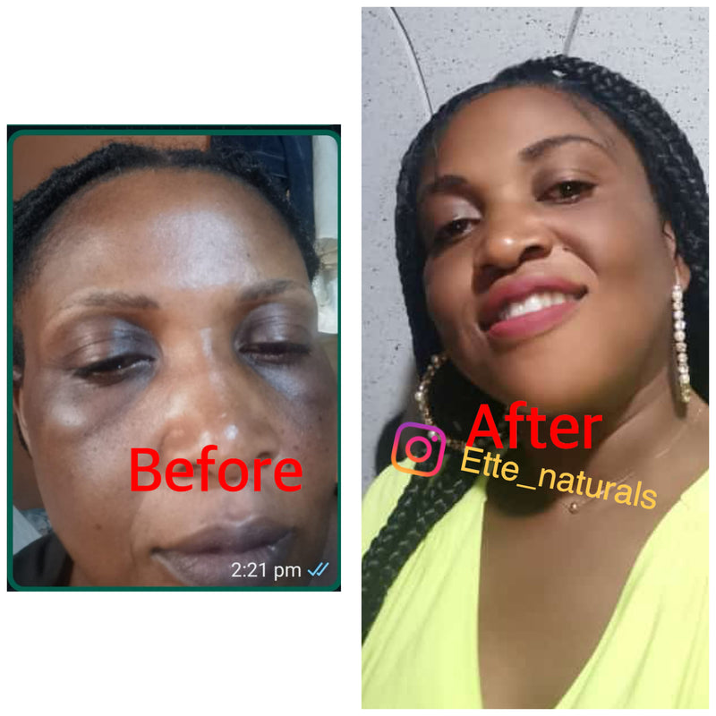 Client result